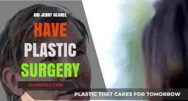 Jerry O'Connell Plastic Surgery: Fact or Fiction? Unveiling the Truth