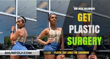 Jess Hilarious Plastic Surgery: Fact-Checking the Transformation Rumors