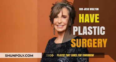 Jess Walton's Transformation: Plastic Surgery Rumors Explored and Debunked