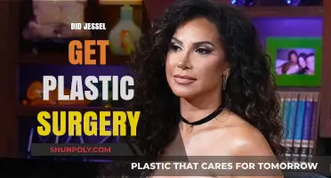 Did Jessel Undergo Plastic Surgery? Uncovering the Truth Behind the Rumors