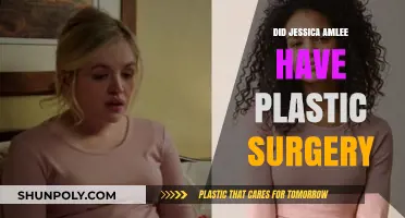 Jessica Amlee Plastic Surgery: Fact-Checking the Rumors and Speculations
