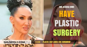 Jessica Dime's Transformation: Plastic Surgery Rumors and Reality Revealed