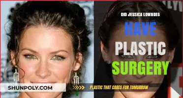 Jessica Lowndes Plastic Surgery: Fact-Checking the Rumors and Speculations