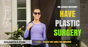 Jessica Mulroney's Transformation: Plastic Surgery Speculations and Truths