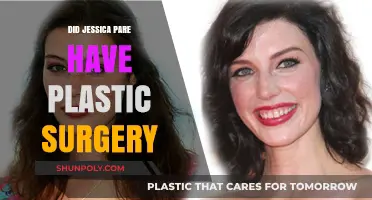 Jessica Paré Plastic Surgery: Fact-Checking the Rumors and Speculations
