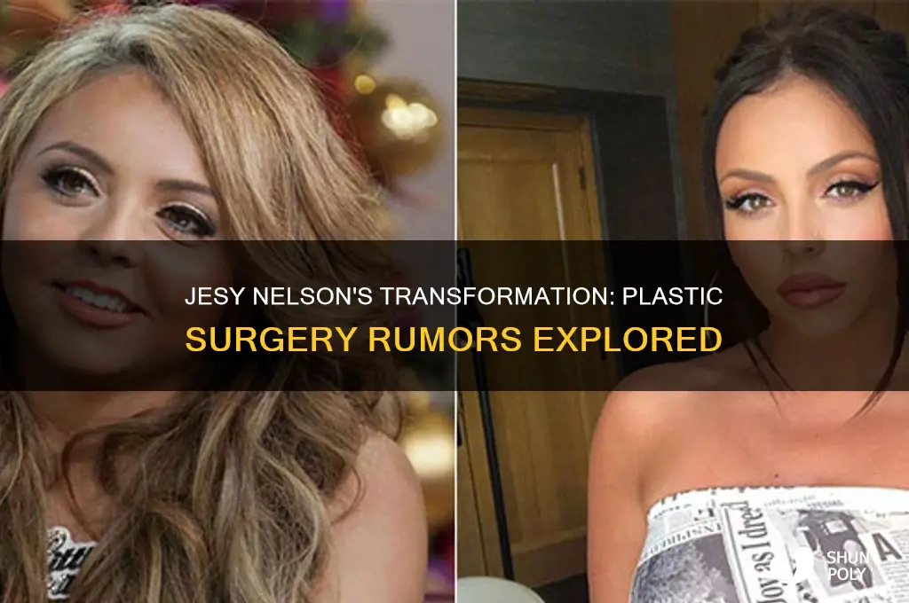 did jesy nelson get plastic surgery