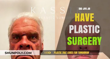 Did JFK Jr. Undergo Plastic Surgery? Uncovering the Truth