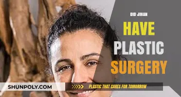 Jihan's Transformation: Unveiling the Truth About Plastic Surgery Rumors