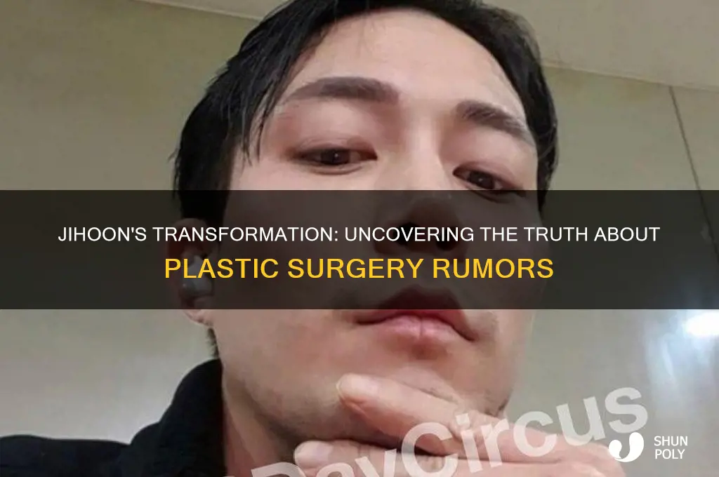 did jihoon get plastic surgery