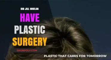 Jill Whelan Plastic Surgery: Fact-Checking the Rumors and Speculations