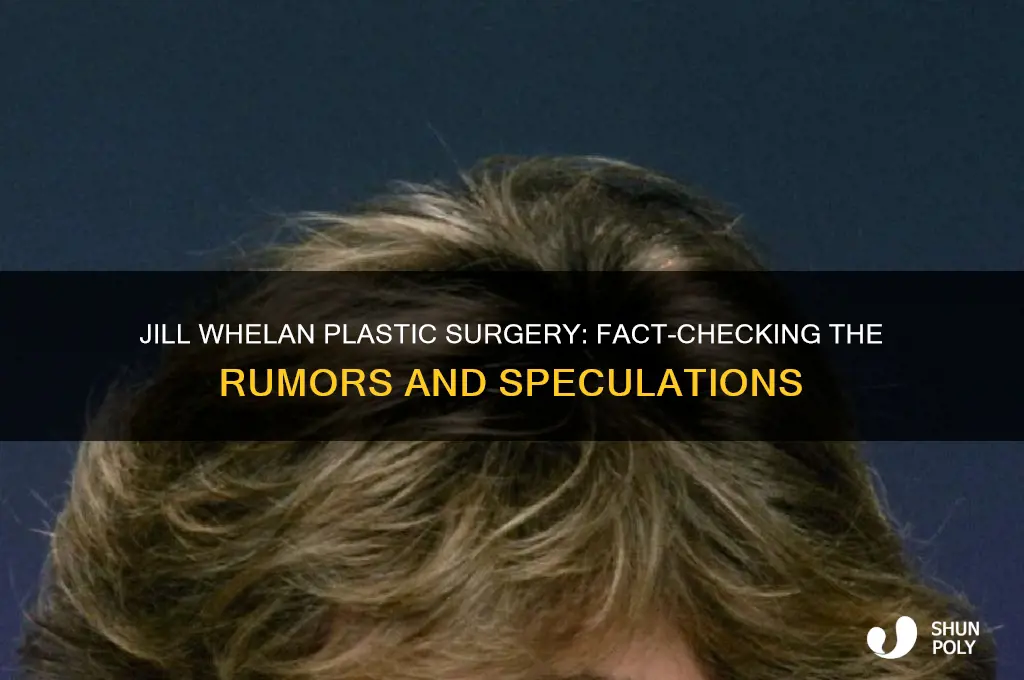 did jill whelan have plastic surgery