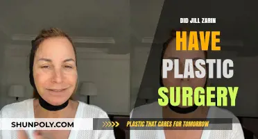 Jill Zarin's Transformation: Plastic Surgery Rumors and Reality Revealed