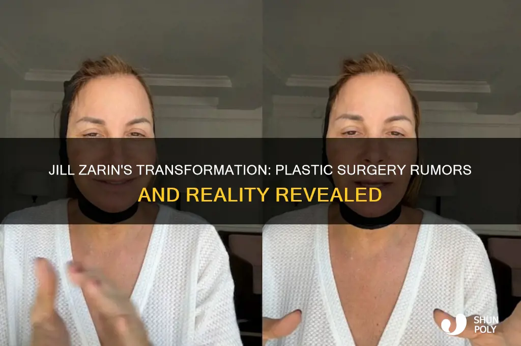 did jill zarin have plastic surgery