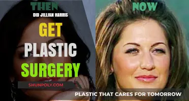 Jillian Harris Plastic Surgery: Fact-Checking the Rumors and Speculations