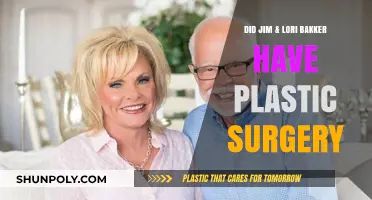 Jim & Lori Bakker's Transformation: Plastic Surgery Speculations Explored