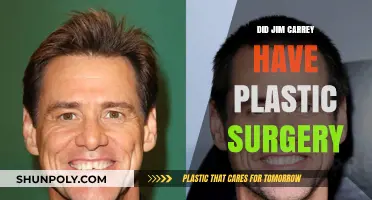 Jim Carrey's Transformation: Plastic Surgery Rumors Explored and Debunked
