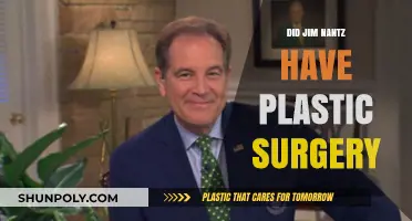 Jim Nantz Plastic Surgery Speculations: Fact or Fiction?