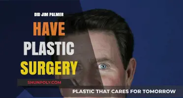 Jim Palmer's Transformation: Plastic Surgery Rumors Explored and Debunked