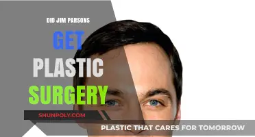 Jim Parsons Plastic Surgery: Fact-Checking the Rumors and Speculations