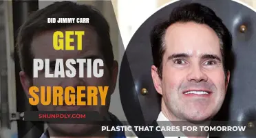 Jimmy Carr's Transformation: Plastic Surgery Speculations and Truths Revealed