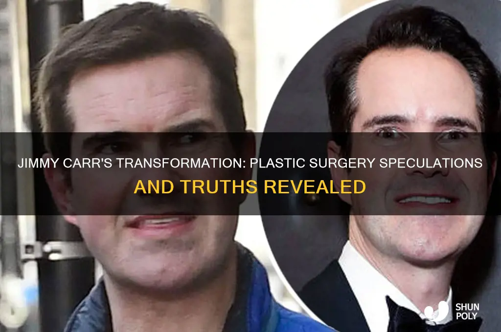 did jimmy carr get plastic surgery