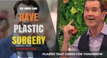 Jimmy Carr's Transformation: Plastic Surgery Speculations and Facts Revealed