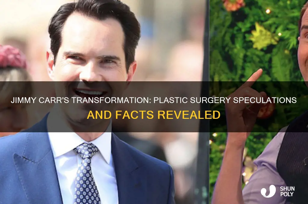 did jimmy carr have plastic surgery