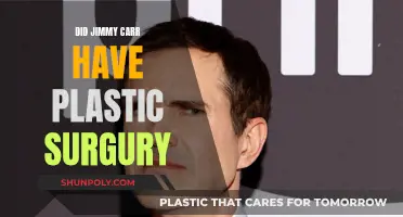 Jimmy Carr's Plastic Surgery: Did He or Didn't He?