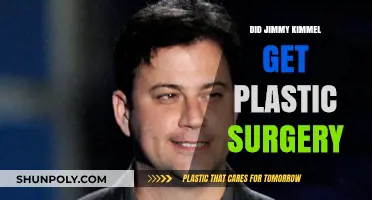Jimmy Kimmel's Transformation: Plastic Surgery Rumors Explored and Debunked