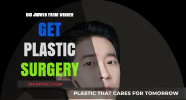 Did Jinwoo from Winner Undergo Plastic Surgery? Unveiling the Truth