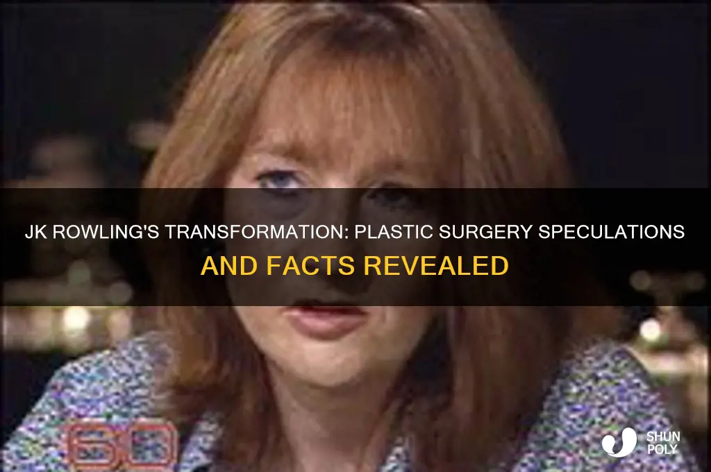 did jk rowling get plastic surgery