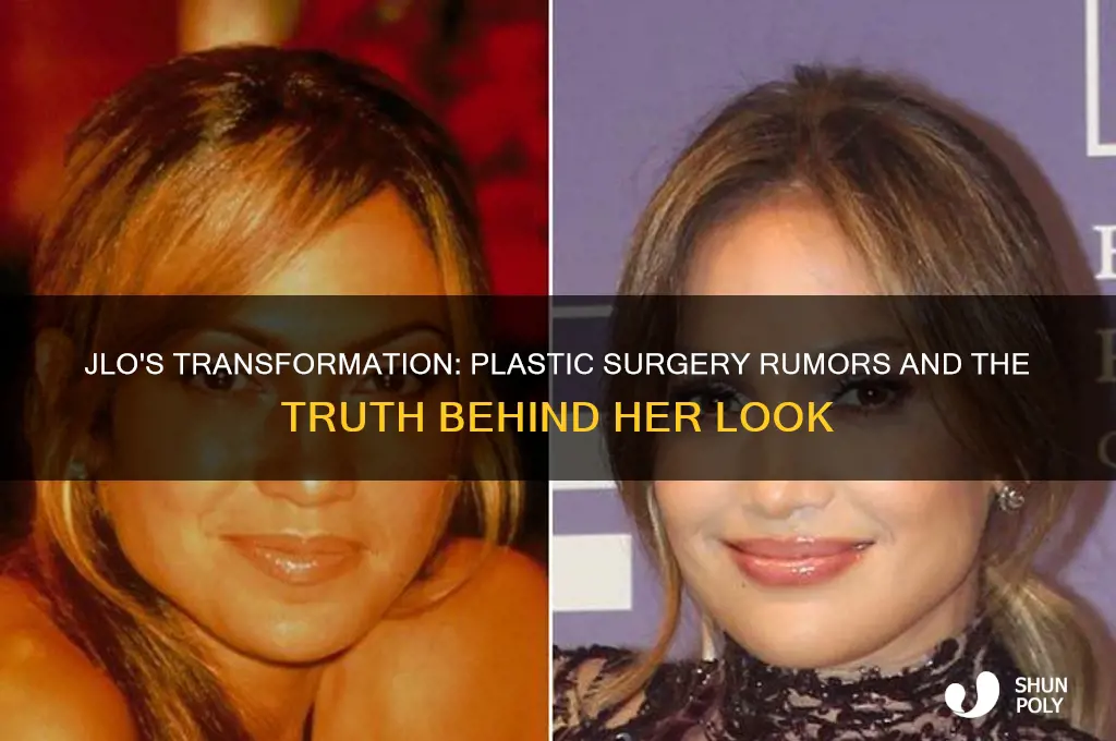 did jlo do plastic surgery