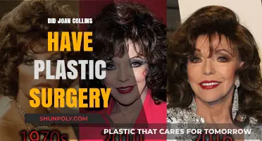 Joan Collins' Ageless Beauty: Plastic Surgery Rumors Explored