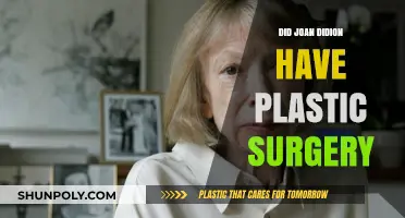 Joan Didion's Appearance: Plastic Surgery Speculations and Truths Revealed