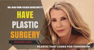 Joan from Golden Bachelorette: Plastic Surgery Speculations and Truths