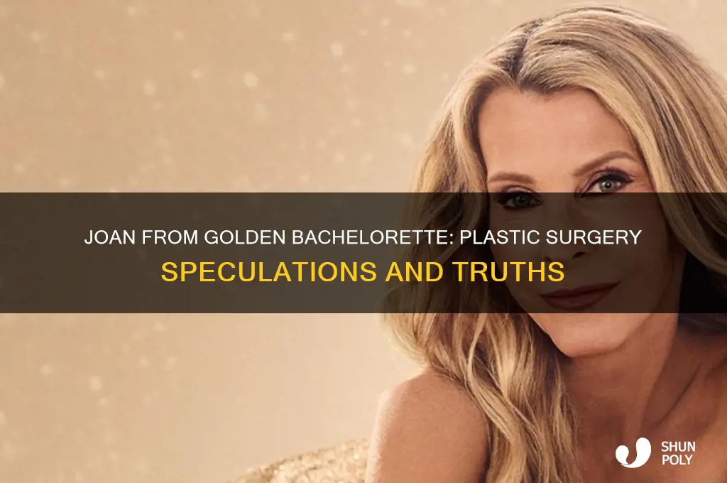 did joan from golden bachelorette have plastic surgery