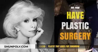 Joan's Transformation: Unveiling the Truth About Her Plastic Surgery