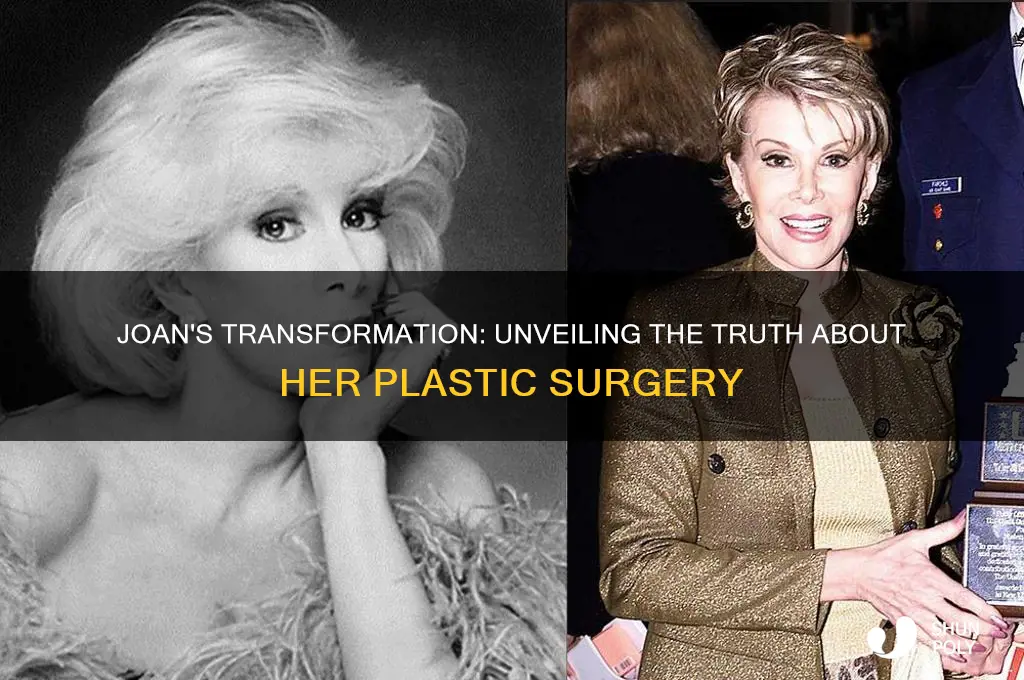 did joan have plastic surgery