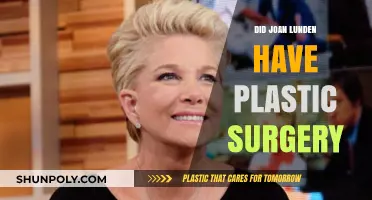 Joan Lunden's Transformation: Plastic Surgery Speculations and Truths Revealed