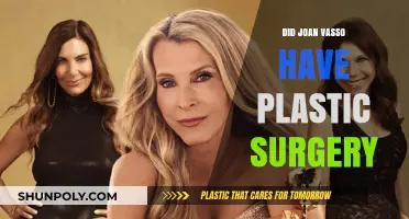 Joan Vasso's Transformation: Plastic Surgery Rumors Explored and Debunked