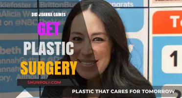 Joanna Gaines Plastic Surgery: Fact-Checking the Rumors and Speculations