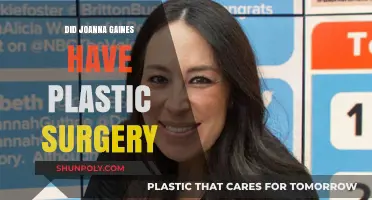 Joanna Gaines Plastic Surgery: Fact-Checking the Rumors and Speculations