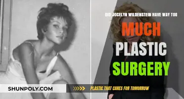 Jocelyn Wildenstein's Extreme Plastic Surgery: Too Far or Iconic Transformation?