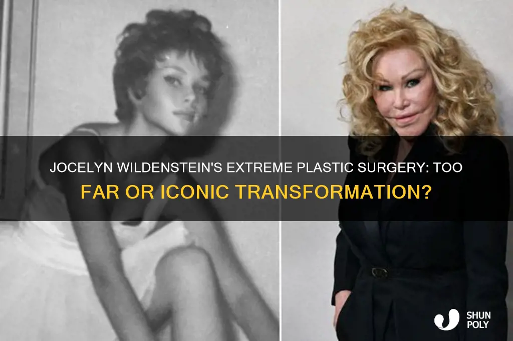 did jocelyn wildenstein have way too much plastic surgery
