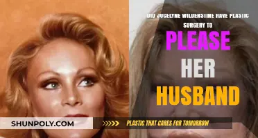 Jocelyne Wildenstein's Extreme Plastic Surgery: A Husband's Influence?