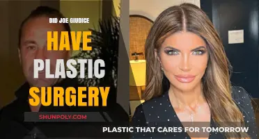 Joe Giudice's Transformation: Plastic Surgery Rumors Explored and Debunked