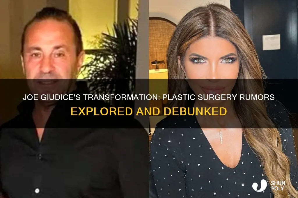 did joe giudice have plastic surgery