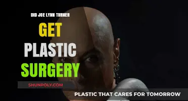 Joe Lynn Turner's Transformation: Plastic Surgery Speculations Explored