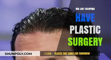 Joe Tacopina's Transformation: Plastic Surgery Speculations Explored