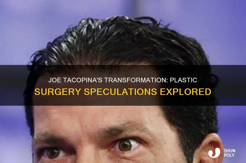 did joe tacopina have plastic surgery